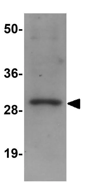 WB analysis of rat brain tissue lysate using GTX85188 TINP1 antibody. Working concentration : (A) 1 and (B) 2 microg/ml