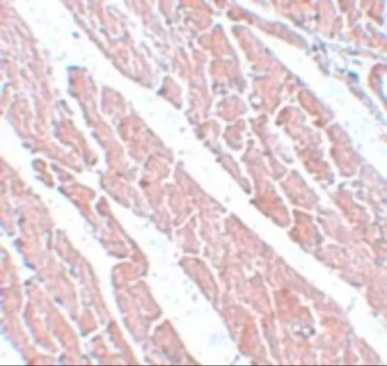 IHC-P analysis of mouse heart tissue using GTX85192 TMEM184C antibody. Working concentration : 5 microg/ml IHC-P analysis of mouse heart tissue using GTX85192 TMEM184C antibody. Working concentration : 5 microg/ml