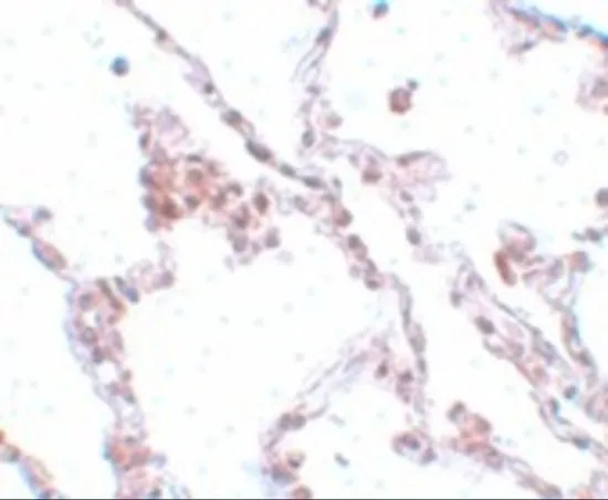 IHC-P analysis of human lung tissue using GTX85193 TMEM184B antibody. Working concentration : 5 microg/ml IHC-P analysis of human lung tissue using GTX85193 TMEM184B antibody. Working concentration : 5 microg/ml