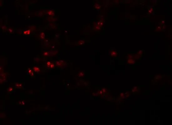 IHC-P analysis of human lung tissue using GTX85193 TMEM184B antibody. Working concentration : 20 microg/ml