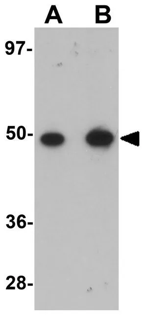 WB analysis of rat lung tissue lysate using GTX85193 TMEM184B antibody. Working concentration : (A) 1 and (B) 2 microg/ml