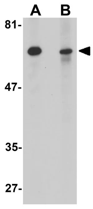 WB analysis of mouse spleen tissue lysate in the (A) absence and (B) presence of blocking peptide using GTX85198 Slc37A2 antibody. Working concentration : 1 ug/ml