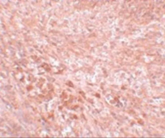 IHC-P analysis of mouse kidney tissue using GTX85204 LZTR2 antibody. Working concentration : 5 microg/ml IHC-P analysis of mouse kidney tissue using GTX85204 LZTR2 antibody. Working concentration : 5 microg/ml