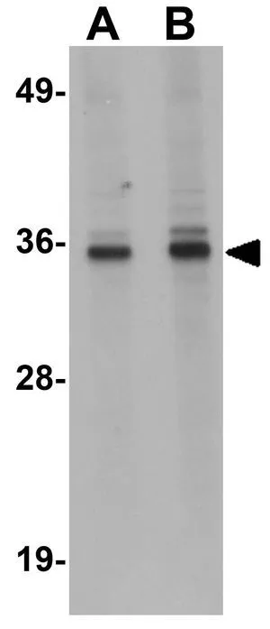 WB analysis of HepG2 cell lysate using GTX85206 RSRC1 antibody. Working concentration : (A) 1 and (B) 2 microg/ml