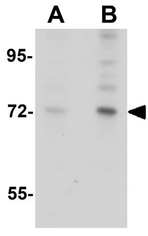 WB analysis of 3T3 cell lysate using GTX85208 ARHGAP18 antibody. Working concentration : (A) 1 and (B) 2 microg/ml WB analysis of 3T3 cell lysate using GTX85208 ARHGAP18 antibody. Working concentration : (A) 1 and (B) 2 microg/ml