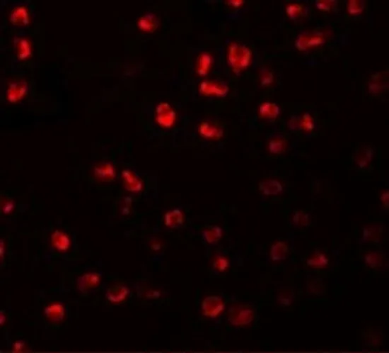 ICC/IF analysis of 3T3 cells using GTX85208 ARHGAP18 antibody. Working concentration : 20 microg/ml