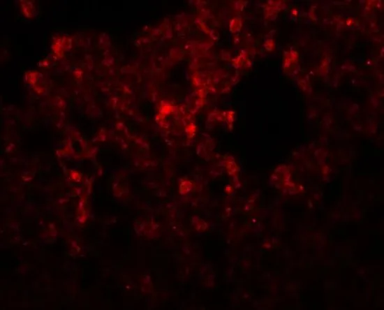 IHC-P analysis of rat lung tissue using GTX85218 RHBDD3 antibody. Working concentration : 20 microg/ml IHC-P analysis of rat lung tissue using GTX85218 RHBDD3 antibody. Working concentration : 20 microg/ml