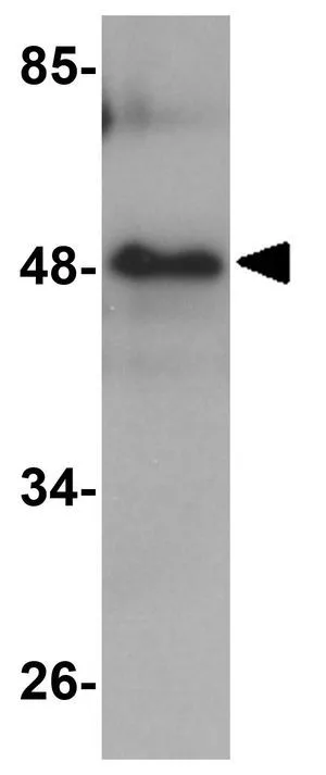 WB analysis of rat lung tissue lysate using GTX85218 RHBDD3 antibody. Working concentration : 1 microg/ml