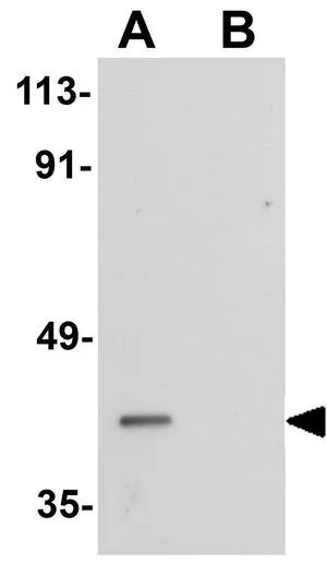 ICC/IF analysis of Raji cells using GTX85222 PPAPDC2 antibody. Working concentration : 20 ug/ml