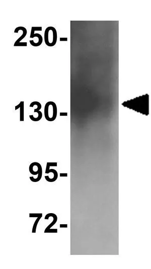 WB analysis of human brain tissue lysate using GTX85225 ZNF536 antibody. Working concentration : 1 microg/ml
