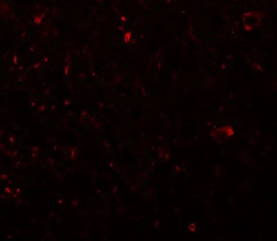 IHC-P analysis of human brain tissue using GTX85229 PLEKHM3 antibody. Working concentration : 20 microg/ml
