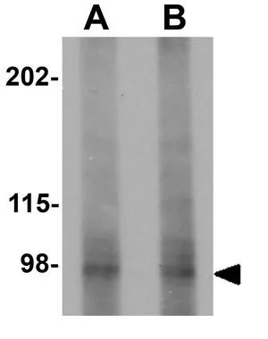 WB analysis of mouse skeletal muscle tissue lysate using GTX85229 PLEKHM3 antibody. Working concentration : (A) 1 and (B) 2 microg/ml