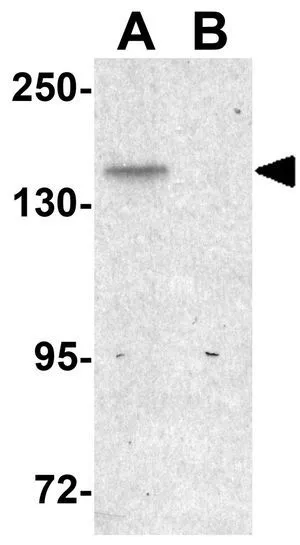 WB analysis of SK-N-SH cell lysate in (A) the absence and (B) the presence of blocking peptide using GTX85230 FAM59B antibody. Working concentration : 1 microg/ml