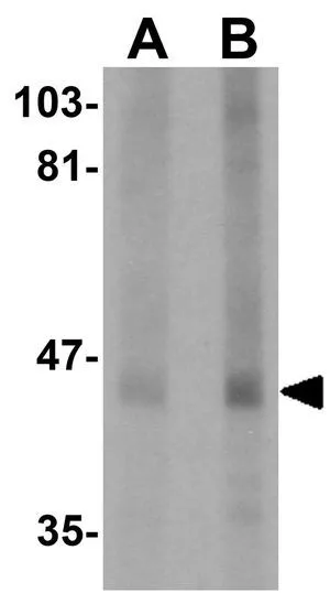 WB analysis of human lung tissue lysate using GTX85240 CKIP1 antibody. Working concentration : (A) 1 and (B) 2 microg/ml WB analysis of human lung tissue lysate using GTX85240 CKIP1 antibody. Working concentration : (A) 1 and (B) 2 microg/ml