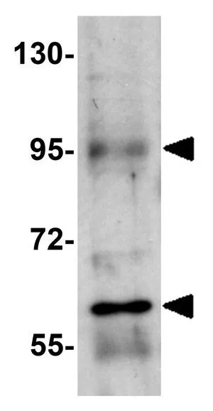 WB analysis of A-20 cell lysate using GTX85244 RUSC1 antibody. Working concentration : 1 microg/ml WB analysis of A-20 cell lysate using GTX85244 RUSC1 antibody. Working concentration : 1 microg/ml