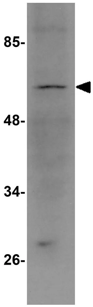 WB analysis of rat liver tissue lysate using GTX85248 TBKBP1 antibody. Working concentration : 1 microg/ml