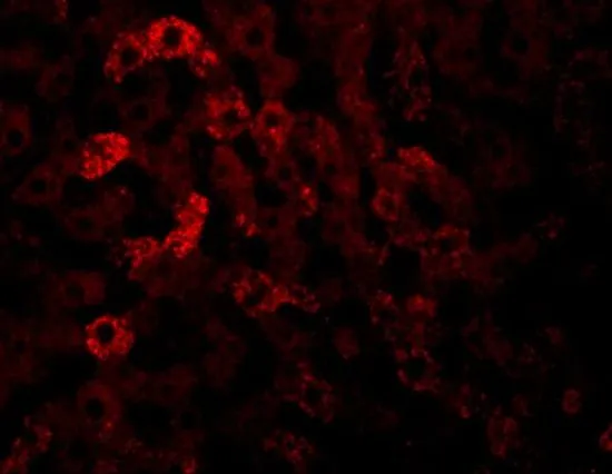 IHC-P analysis of rat liver tissue using GTX85250 JMJD7 antibody. Working concentration : 20 microg/ml