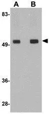 WB analysis of rat brain tissue lysate using GTX85256 TMEM214 antibody. Working concentration : (A) 1 and (B) 2 microg/ml WB analysis of rat brain tissue lysate using GTX85256 TMEM214 antibody. Working concentration : (A) 1 and (B) 2 microg/ml