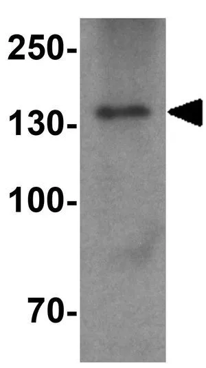 WB analysis of SK-N-SH cell lysate using GTX85263 PALB2 antibody. Working concentration : 1 microg/ml WB analysis of SK-N-SH cell lysate using GTX85263 PALB2 antibody. Working concentration : 1 microg/ml