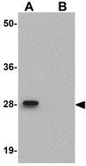 WB analysis of mouse kidney tissue lysate in (A) the absence and (B) the presence of blocking peptide using GTX85269 LIAR antibody. Working concentration : 1 microg/ml
