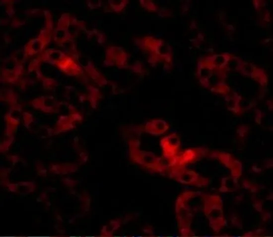 IHC-P analysis of mouse kidney tissue using GTX85269 LIAR antibody. Working concentration : 20 microg/ml