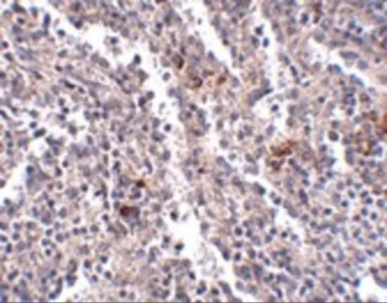 IHC-P analysis of human spleen tissue using GTX85272 SYPL2 antibody. Working concentration : 2.5 microg/ml IHC-P analysis of human spleen tissue using GTX85272 SYPL2 antibody. Working concentration : 2.5 microg/ml