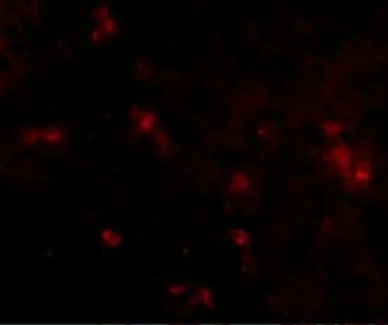 ICC/IF analysis of human spleen cells using GTX85272 SYPL2 antibody. Working concentration : 20 microg/ml