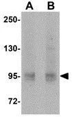 WB analysis of 293 cell lysate using GTX85273 EphA10 antibody. Working concentration : (A) 1 and (B) 2 microg/ml WB analysis of 293 cell lysate using GTX85273 EphA10 antibody. Working concentration : (A) 1 and (B) 2 microg/ml