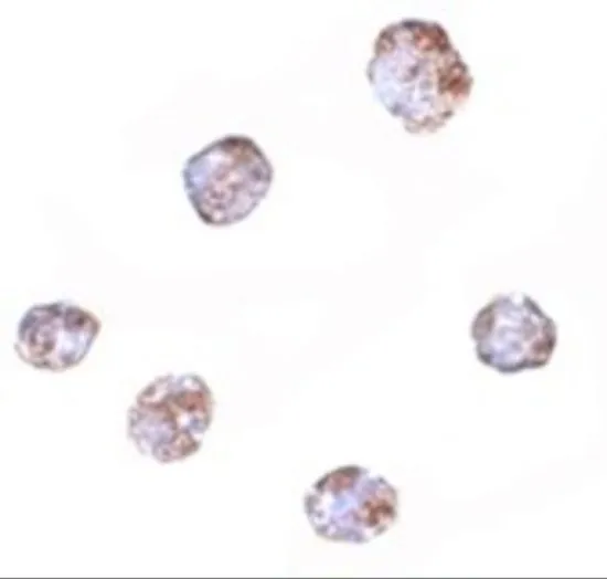 ICC/IF analysis of HepG2 cells using GTX85280 RGS21 antibody. Working concentration : 2.5 microg/ml