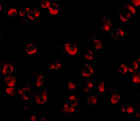 ICC/IF analysis of HepG2 cells using GTX85280 RGS21 antibody. Working concentration : 20 microg/ml