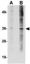 WB analysis of HeLa cell lysate using GTX85283 ST3gal6 antibody. Working concentration : (A) 1 and (B) 2 microg/ml WB analysis of HeLa cell lysate using GTX85283 ST3gal6 antibody. Working concentration : (A) 1 and (B) 2 microg/ml
