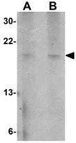WB analysis of A549 cell lysate using GTX85291 ZBED2 antibody. Working concentration : (A) 1 and (B) 2 microg/ml WB analysis of A549 cell lysate using GTX85291 ZBED2 antibody. Working concentration : (A) 1 and (B) 2 microg/ml