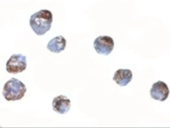 ICC/IF analysis of A549 cells using GTX85291 ZBED2 antibody. Working concentration : 5 microg/ml