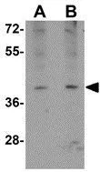 WB analysis of A-20 cell lysate using GTX85296 ATOH8 antibody. Working concentration : (A) 1 and (B) 2 microg/ml
