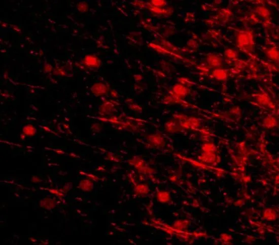 IHC-P analysis of mouse brain tissue using GTX85341 LRFN4 antibody. Working concentration : 20 microg/ml