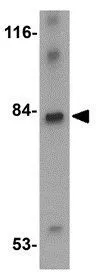 WB analysis of rat brain tissue lysate using GTX85341 LRFN4 antibody. Working concentration : 1 microg/ml