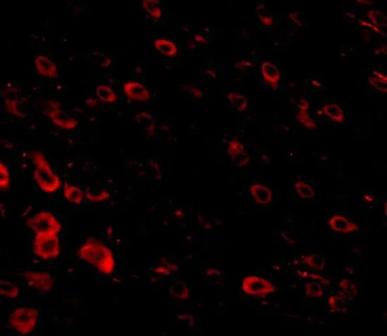 IHC-P analysis of mouse brain tissue using GTX85343 LRFN3 antibody. Working concentration : 20 microg/ml