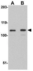 WB analysis of K562 cell lysate using GTX85343 LRFN3 antibody. Working concentration : (A) 1 and (B) 2 microg/ml