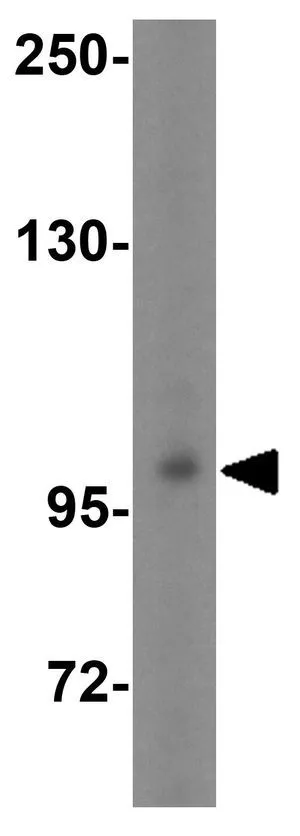 WB analysis of mouse brain tissue lysate using GTX85344 LRFN2 antibody. Working concentration : 1 microg/ml