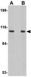WB analysis of rat brain tissue lysate using GTX85344 LRFN2 antibody. Working concentration : (A) 1 and (B) 2 microg/ml