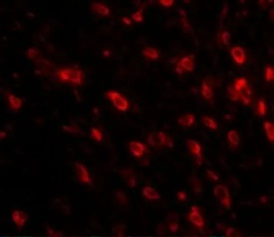 IHC-P analysis of human brain tissue using GTX85349 TTBK1 antibody. Working concentration : 20 microg/ml IHC-P analysis of human brain tissue using GTX85349 TTBK1 antibody. Working concentration : 20 microg/ml