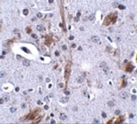 IHC-P analysis of mouse brain tissue using GTX85349 TTBK1 antibody. Working concentration : 2.5 microg/ml