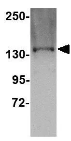 WB analysis of Jurkat cell lysate using GTX85349 TTBK1 antibody. Working concentration : 1 microg/ml