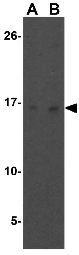 IHC-P analysis of human spleen tissue using GTX85355 PIG-Y antibody. Working concentration : 20 ug/ml