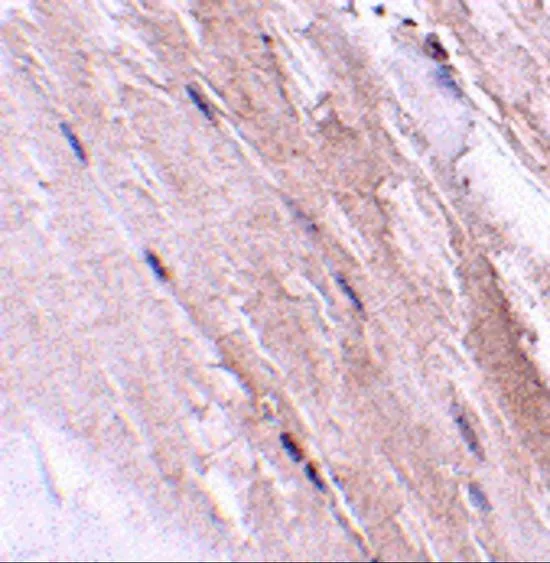 IHC-P analysis of mouse skeletal muscle tissue using GTX85361 GBAS antibody. Working concentration : 2.5 microg/ml IHC-P analysis of mouse skeletal muscle tissue using GTX85361 GBAS antibody. Working concentration : 2.5 microg/ml