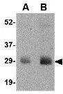 WB analysis of human skeletal muscle tissue lysate using GTX85361 GBAS antibody. Working concentration : (A) 0.5 and (B) 1 microg/ml
