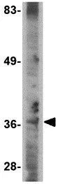 WB analysis of A-20 cell lysate using GTX85371 METTL7A antibody. Working concentration : 2 microg/ml WB analysis of A-20 cell lysate using GTX85371 METTL7A antibody. Working concentration : 2 microg/ml