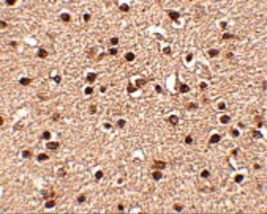 IHC-P analysis of human brain tissue using GTX85373 Dact2 antibody. Working concentration : 2.5 microg/ml IHC-P analysis of human brain tissue using GTX85373 Dact2 antibody. Working concentration : 2.5 microg/ml
