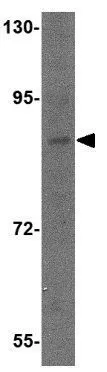 WB analysis of SK-N-SH cell lysate using GTX85373 Dact2 antibody. Working concentration : 1 microg/ml