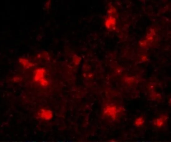 IHC-P analysis of human brain tissue using GTX85373 Dact2 antibody. Working concentration : 20 microg/ml